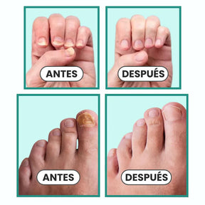 OrthoVital® Solución triple acción —combate, cura y refuerza— para tus uñas